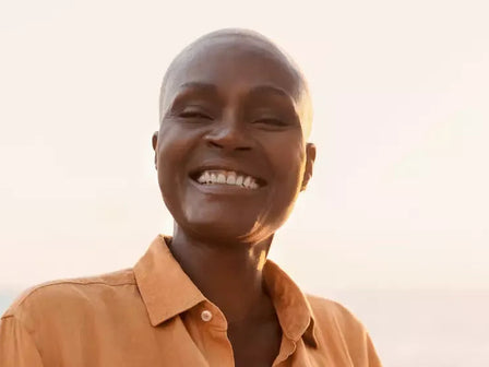 Alopecia totalis: volledige kaalheid