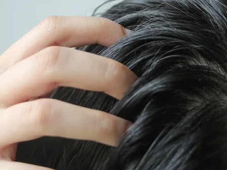 De ideale scrub voor hoofdhuidproblemen