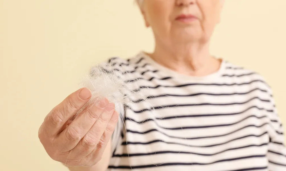 Involutional alopecia