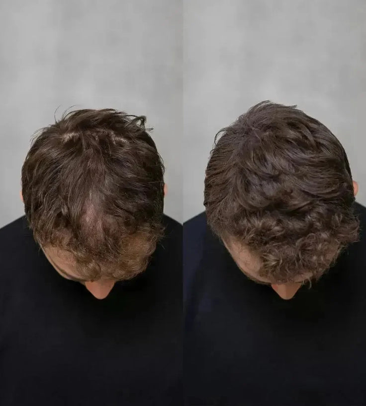 3x Keratain haarvezels + gratis Keratain pommade - Donkerbruin (25 gr) - Hairgivers