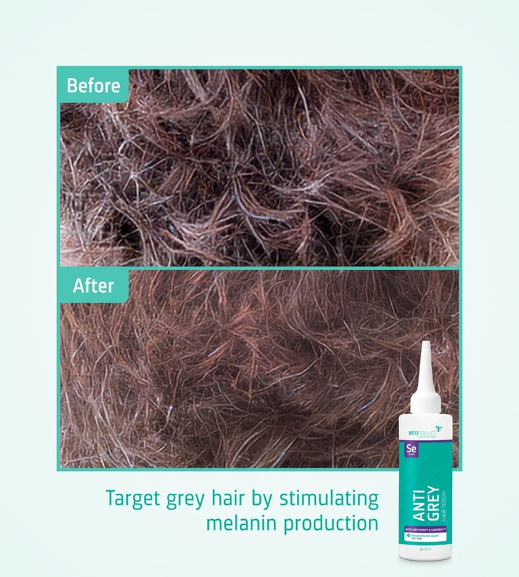 Neofollics Anti Grey Hair Serum