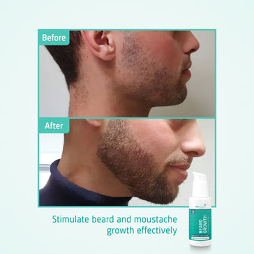 Neofollics Beard Growth Serum 3-pack (7% Neoxyl) Neofollics Beard Growth Serum 3-pack (7% Neoxyl)