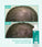 Neofollics Conditioner (250 ml)