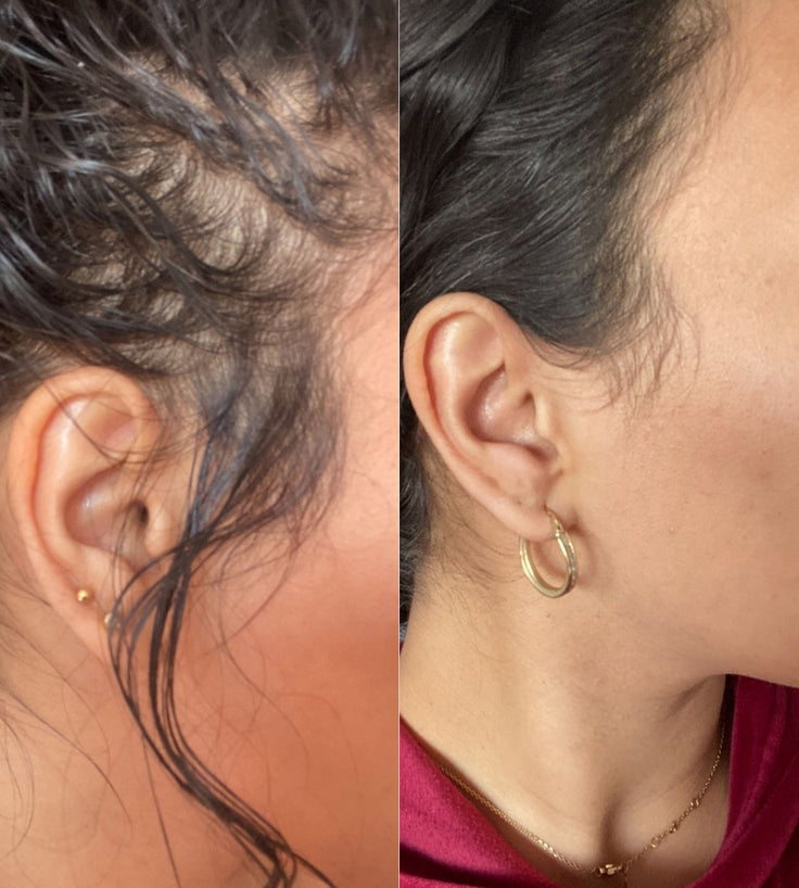 Golden Effect Serum + Mask + Scrub (vette hoofdhuid)