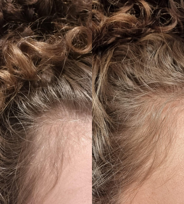 Golden Effect Serum + Mask + Scrub (vette hoofdhuid)