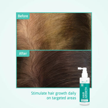 Neofollics Lotion haargroei serum 3-pack (7% Neoxyl) Neofollics haargroei lotion 3-pack (7% Neoxyl) - Hairgivers