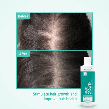 Neofollics Shampoo tegen haaruitval 3-pack (3x250 ml) Neofollics haargroei shampoo 3-pack (3x250 ml) - Hairgivers