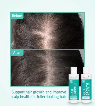 Neofollics Shampoo + Conditioner Starter Kit Neofollics haargroei shampoo + conditioner starter kit - Hairgivers
