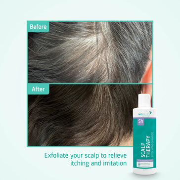 Neofollics Scalp Therapy Exfoliating Shampoo Neofollics exfoliating shampoo - Hairgivers