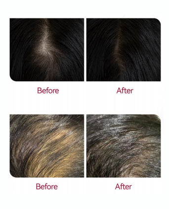 Beaver Anti-Hair Loss Shampoo + Serum + Applicator Beaver Anti-Hair Loss Shampoo + Serum + Applicator