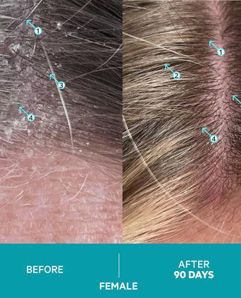 Dandrene anti-roos shampoo Dandrene anti-roos shampoo