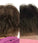Foligain haargroei behandeling (vrouw) - Hairgivers