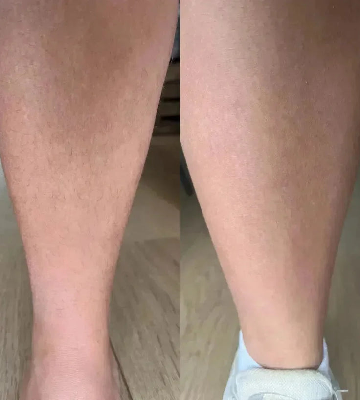 Keramene body hair minimizer ontharingscrème - Hairgivers