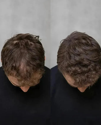 Keratain haarvezels - Lichtbruin (25 gr) Keratain haarvezels - Lichtbruin (25 gr) - Hairgivers
