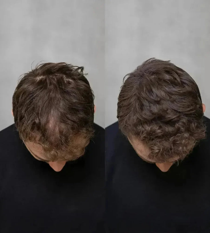 Keratain haarvezels - Medium bruin (25 gr) - Hairgivers