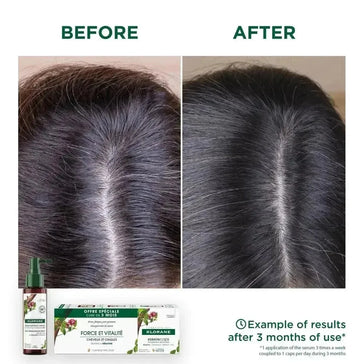Klorane anti-haaruitval behandeling Klorane anti-haaruitval behandeling - Hairgivers