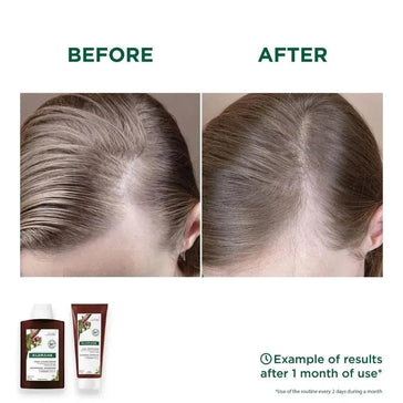 Klorane anti-haaruitval shampoo + conditioner Klorane anti-haaruitval shampoo + conditioner - Hairgivers