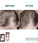 Klorane anti-haaruitval shampoo + conditioner - Hairgivers