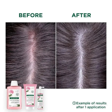 Klorane behandeling voor gevoelige hoofdhuid Klorane behandeling voor gevoelige hoofdhuid - Hairgivers