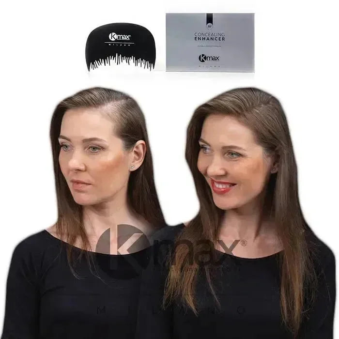Kmax haarlijn optimalisator - Hairgivers