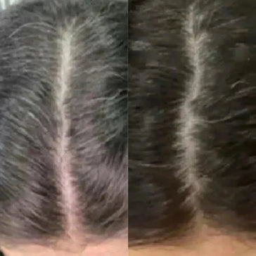 Neofollics Anti Grey Hair Tablets Neofollics anti-grey hair tablets - Hairgivers