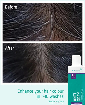 Neofollics Anti Grey Hair Shampoo Neofollics anti-grey shampoo - Hairgivers