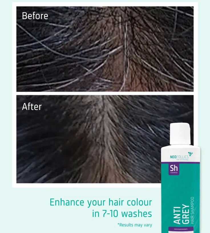 Neofollics anti-grey shampoo - Hairgivers