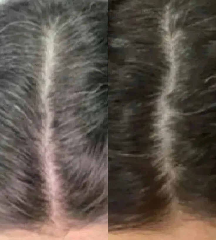 Neofollics anti-grey tablets (3-pack) - Hairgivers