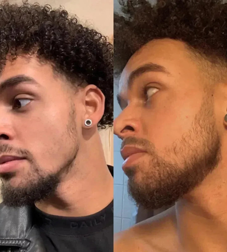 Neofollics baardgroei serum (7% Neoxyl) - Hairgivers