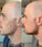 Neofollics baardroller (0,5 mm) - Hairgivers