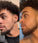 Neofollics baardroller (0,5 mm) - Hairgivers