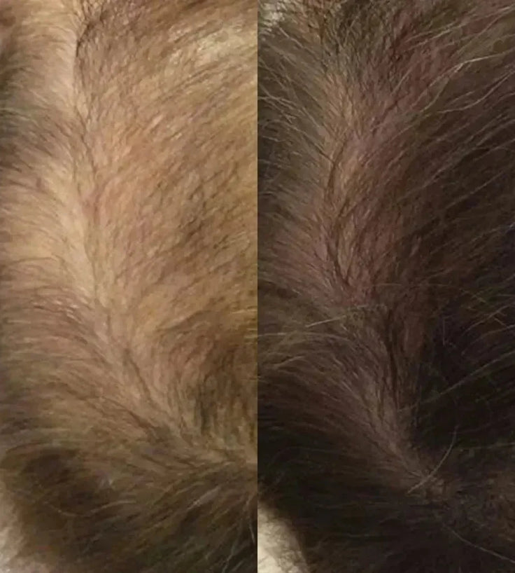 Neofollics haargroei lotion (7% Neoxyl) - Hairgivers