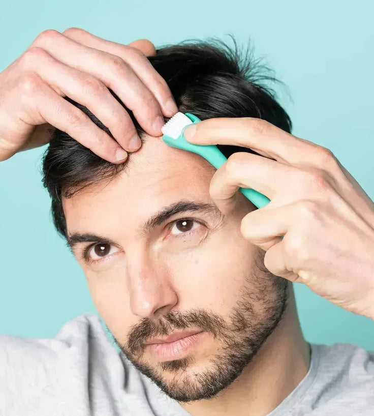 Neofollics scalp roller (0,3 mm) - Hairgivers