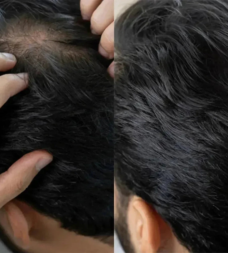 Panthrix haargroei serum 3-pack (Redensyl) - Hairgivers