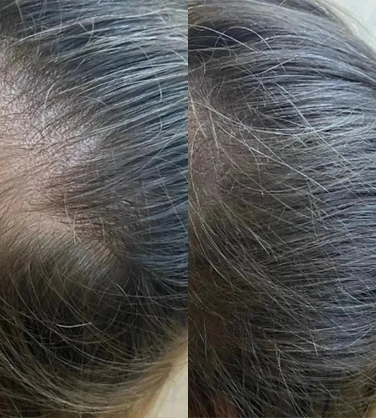 Panthrix haargroei serum (Redensyl) - Hairgivers
