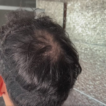 3x Keratain haarvezels + gratis Keratain pommade 3x Keratain haarvezels + gratis Keratain pommade - Hairgivers