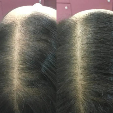 Revita conditioner (925 ml) Revita conditioner (925 ml)