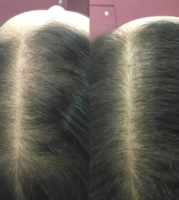 Revita conditioner (925 ml) Revita conditioner (925 ml)