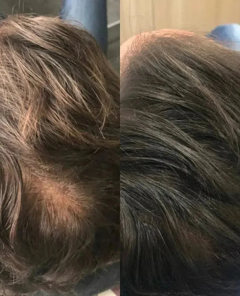 Revita haargroei shampoo (205 ml) Revita haargroei shampoo (205 ml)