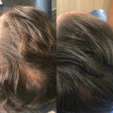 Revita haargroei shampoo (205 ml) Revita haargroei shampoo (205 ml)