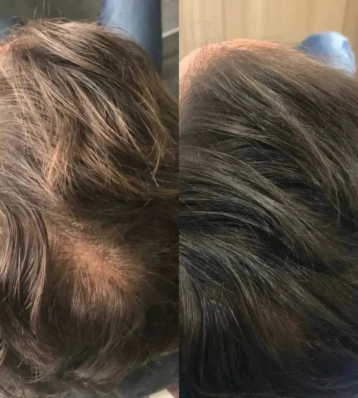 Revita haargroei shampoo + conditioner (205 ml) - Hairgivers