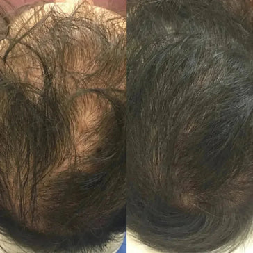 Revita haargroei shampoo + conditioner (205 ml) Revita haargroei shampoo + conditioner (205 ml)