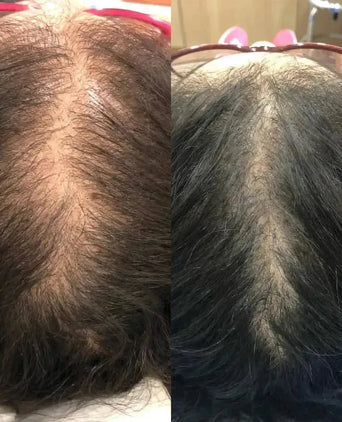 Revita haargroei shampoo + conditioner (925 ml) Revita haargroei shampoo + conditioner (925 ml)