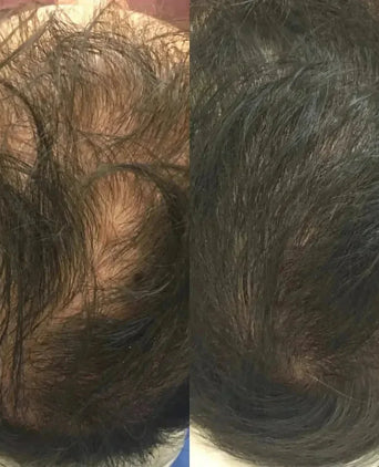 Revita haargroei shampoo + conditioner (925 ml) Revita haargroei shampoo + conditioner (925 ml)