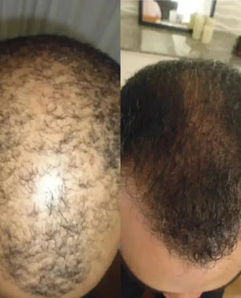 Revita tablets tegen haaruitval (1 mnd) Revita tablets tegen haaruitval (1 mnd)