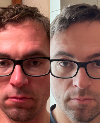 Scandinavian Biolabs Bio-Pilixin Hairline Booster navulling (3-pack) Scandinavian Biolabs Bio-Pilixin Hairline Booster navulling (3-pack)