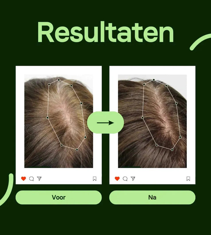 Scandinavian Biolabs Bio-Pilixin serum (man) - Hairgivers