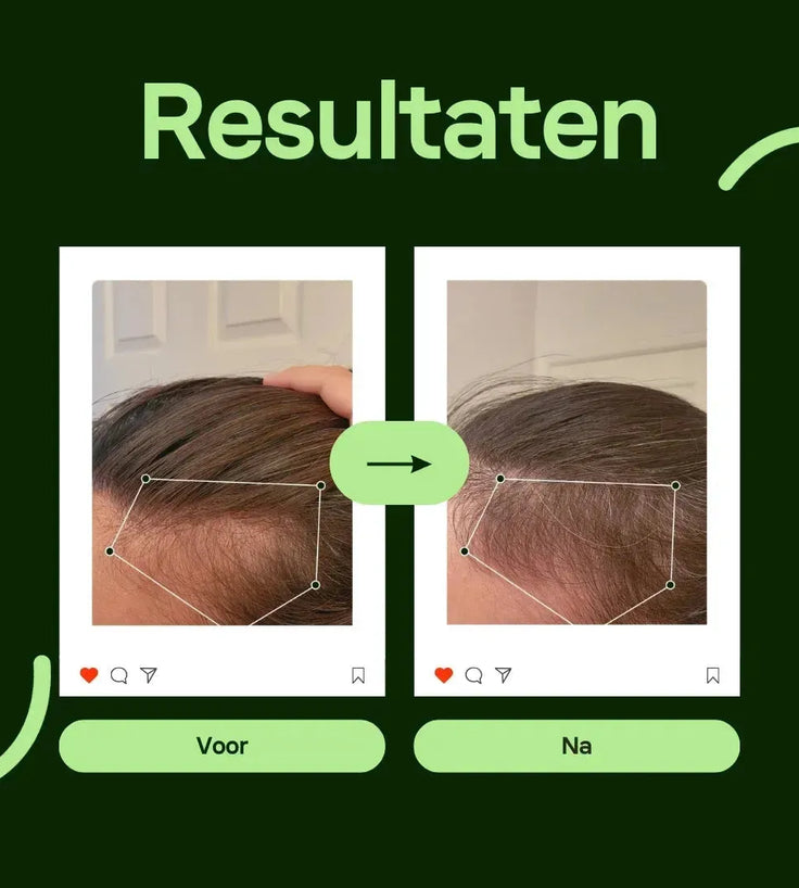 Scandinavian Biolabs Bio-Pilixin serum (man) - Hairgivers