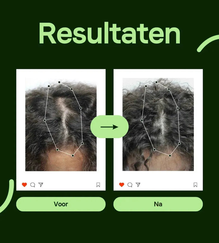 Scandinavian Biolabs Bio-Pilixin serum (vrouw) - Hairgivers