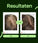 Scandinavian Biolabs Bio-Pilixin serum (vrouw) - Hairgivers